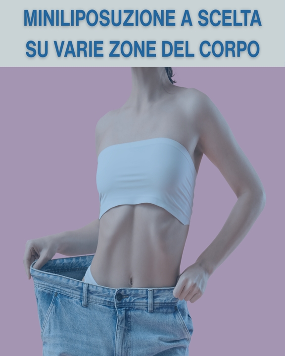 EURO 1900 INVECE DI 3500 COUPON 94 VEDI OFFERTA